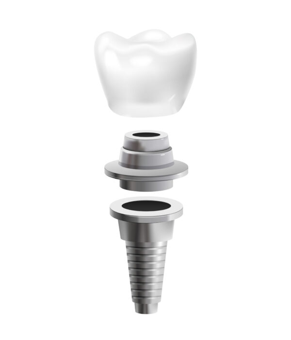 Dental Post Icon Metal dental post realistic icon isolated vector illustration