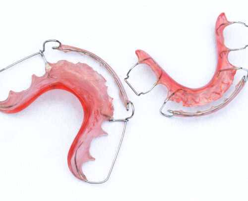 Ealing-Dental-Specialists-removable-appliance Ealing-Dental-Specialists-removable-appliance