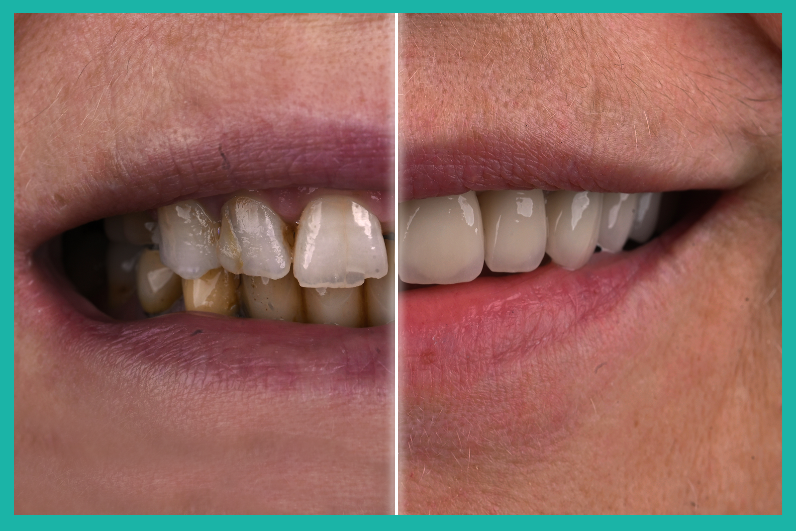 beforeafter3