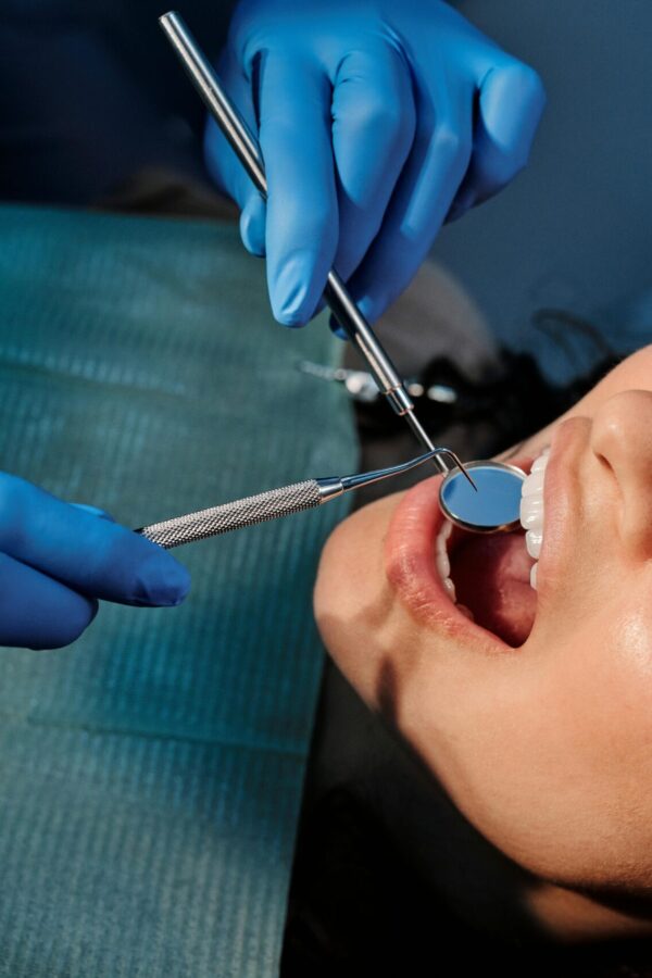 veneers-pic veneers-pic