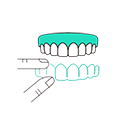 Impianti Dentali