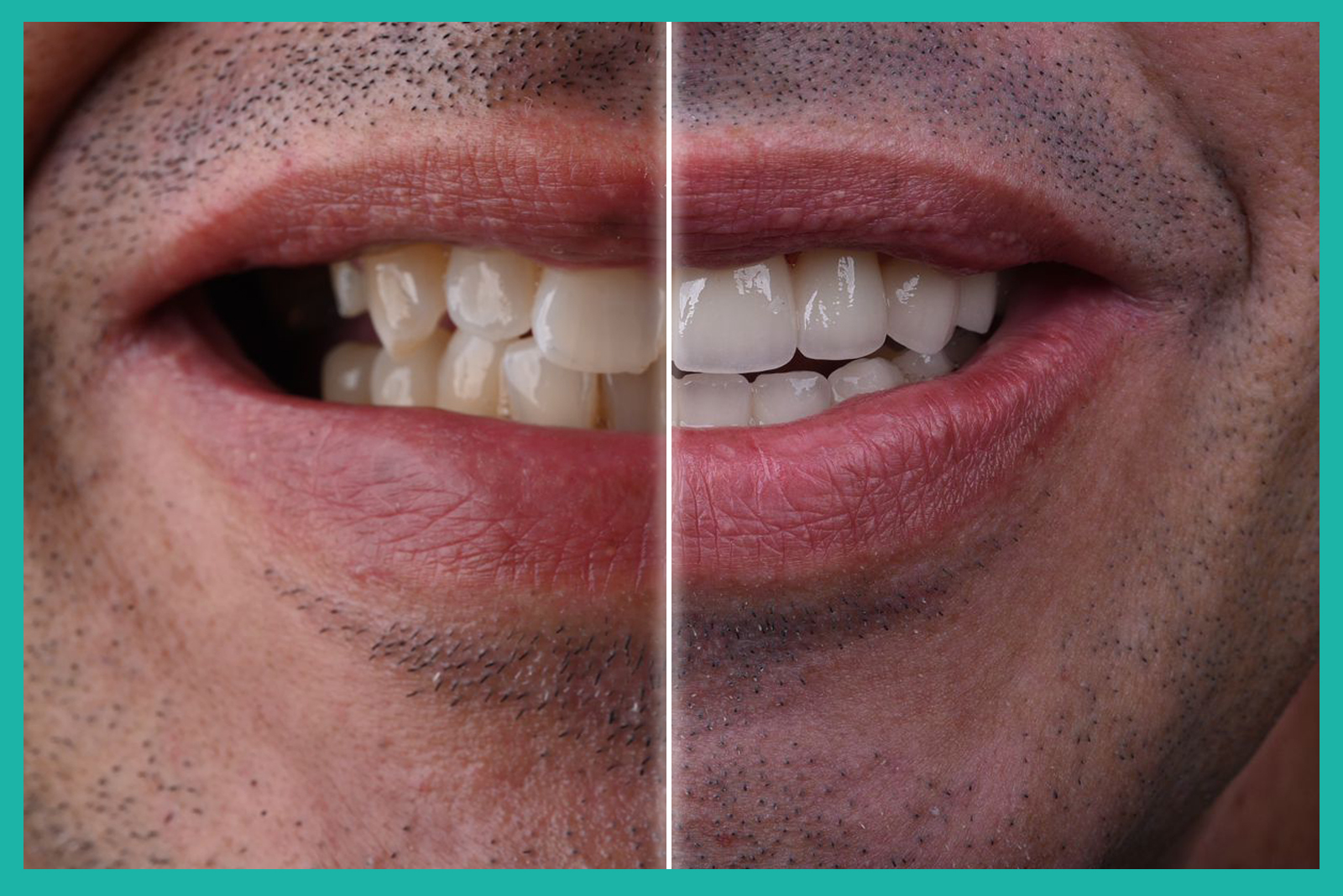 beforeafter2