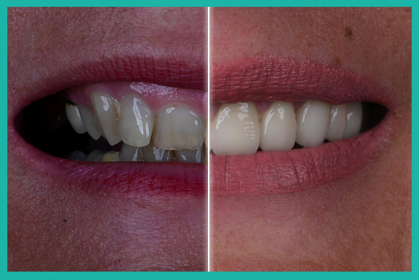beforeafter1